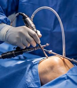 Artroscopia de rodilla